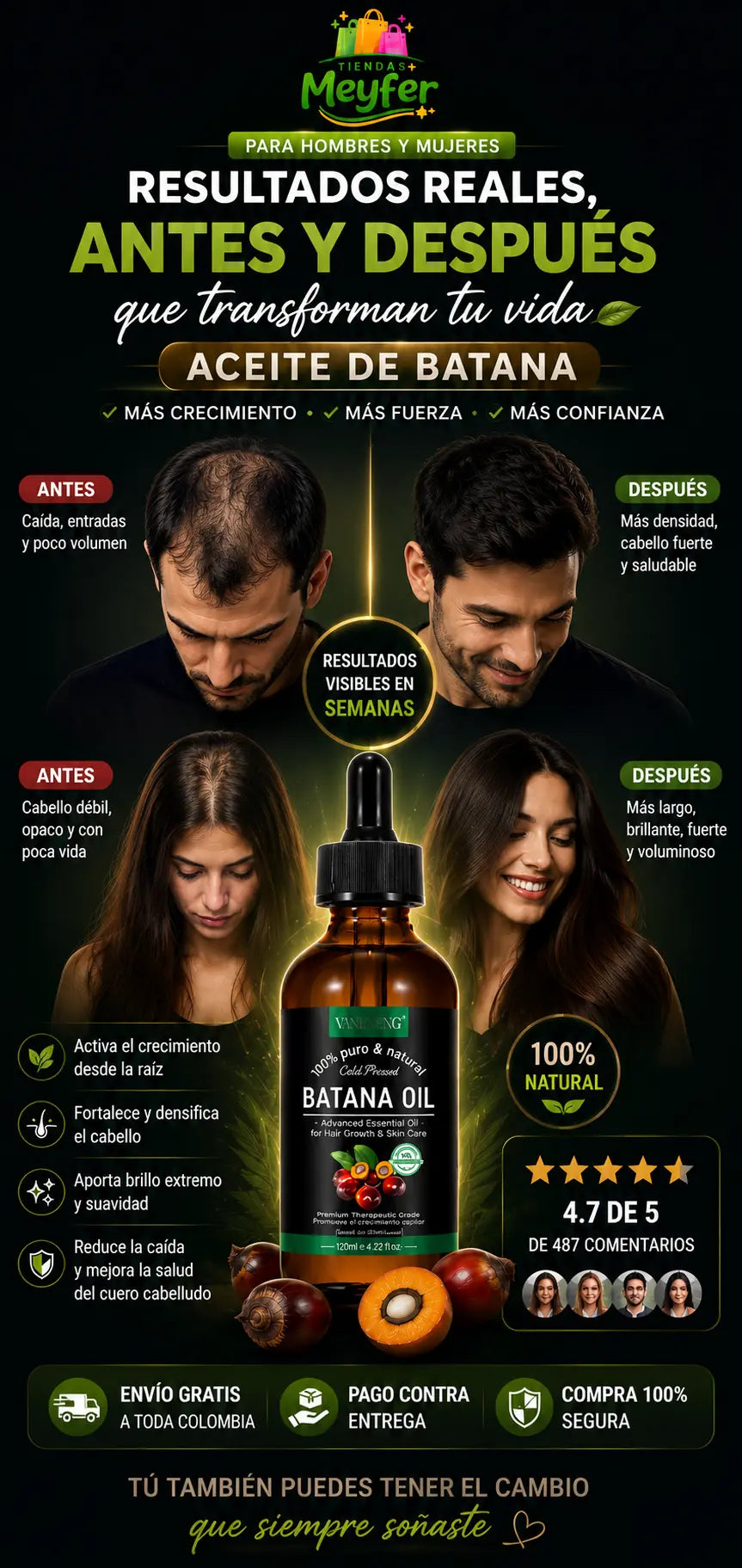 ACEITE DE BATANA -🌿👴TU RAYA DEL CABELLO SE VE CADA VEZ MÁS ANCHA ❓🌿