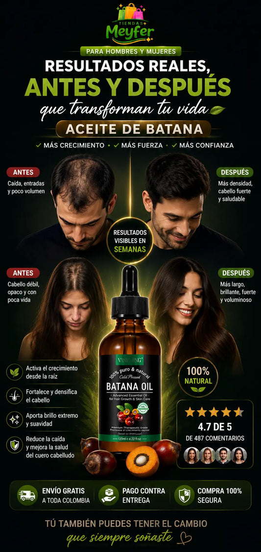 ACEITE DE BATANA -🌿👴TU RAYA DEL CABELLO SE VE CADA VEZ MÁS ANCHA ❓🌿